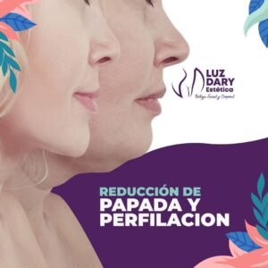 Reducción papada