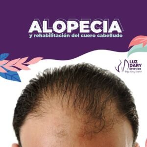 Alopecia